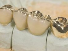 Какая проба золота лучше - 375 или 585? Плюсы и минусы, чем отличаются на самом деле. Как отличить золото 375 пробы от 585